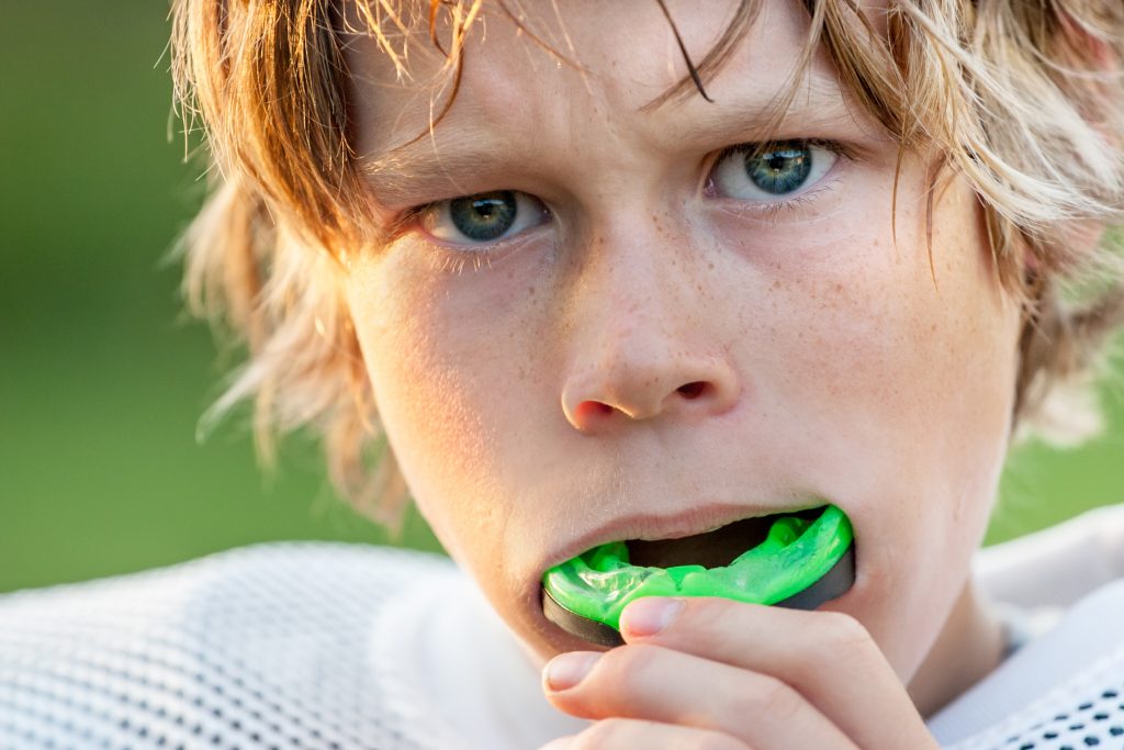 Mouthguards