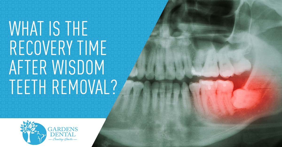 Average Recovery Time For 4 Wisdom Teeth Removal