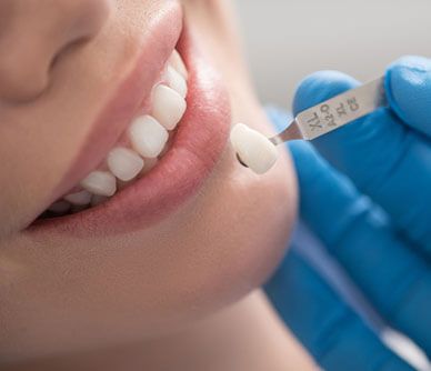 dental crowns caroline springs
